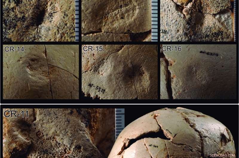 Sima de los Huesos Skulls: Forensic Analysis Reveals Ancient Trauma and Health