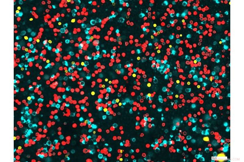 Advanced Immune Cell Analysis in Lung Clinical Trials: A New Procedure
