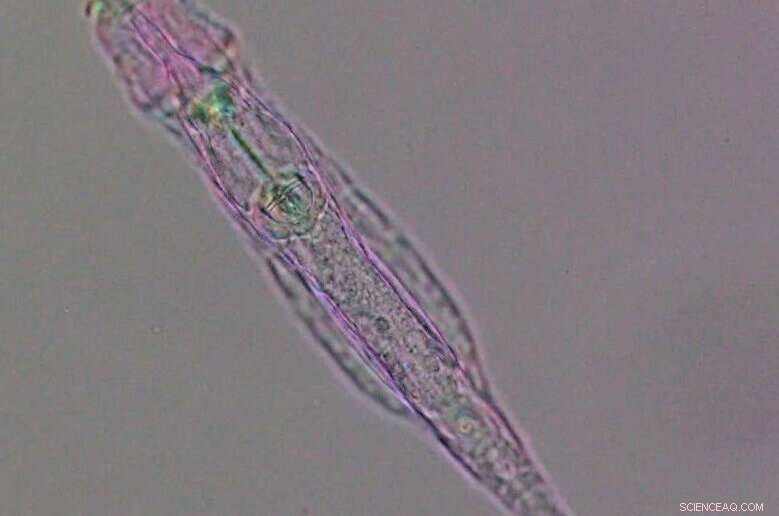 Ancient DNA Modification System Discovered in Rotifers - 60 Million Years Old