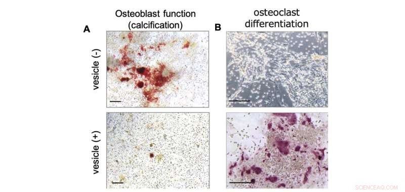 Advanced Microscopy Reveals Bone Remodeling Processes