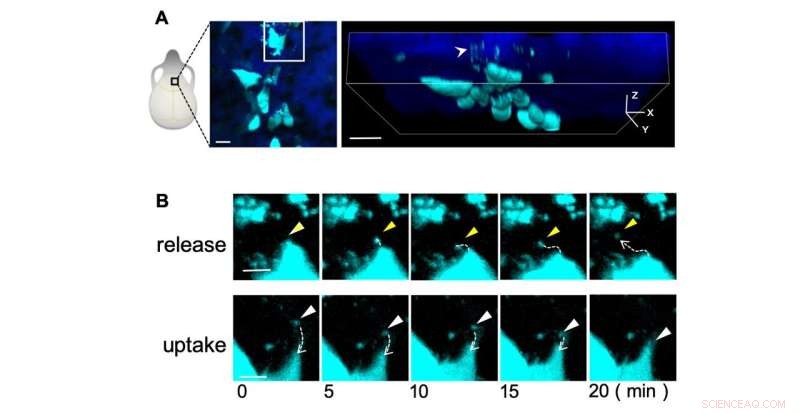 Advanced Microscopy Reveals Bone Remodeling Processes