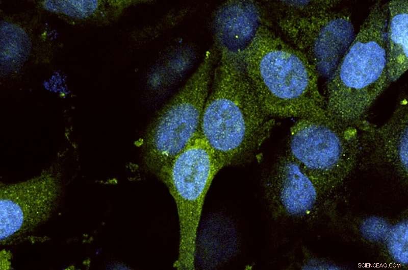 Viral Defense: New Research Reveals How Human Cells Fight Infection