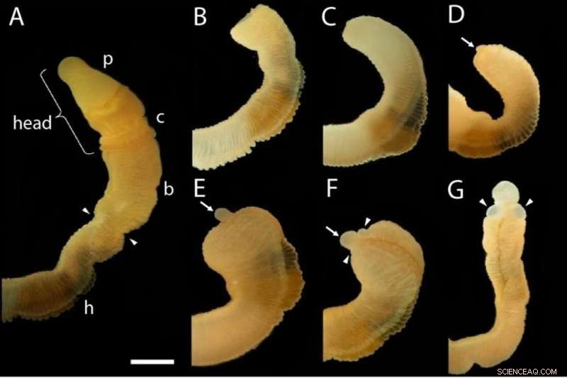 Acorn Worm Regeneration: Insights into Vertebrate Body Repair
