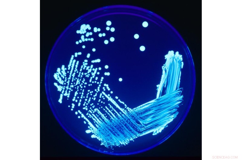 Ancient Origins of Legionella: 2 Billion-Year-Old Infection