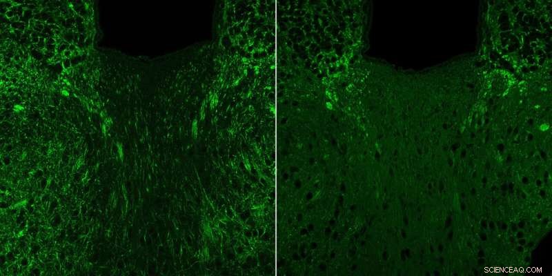 Gut Bacteria Metabolite Linked to Anxiety in Mice - Caltech Research