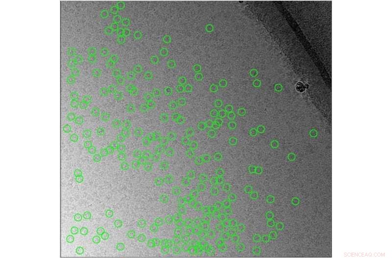 Cryo-EM Ice Contamination: Challenges and Solutions