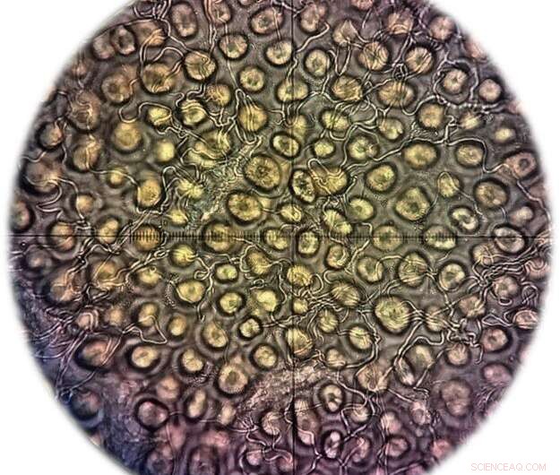 Ergot Disease: A Surprising Defense Mechanism Against Pests