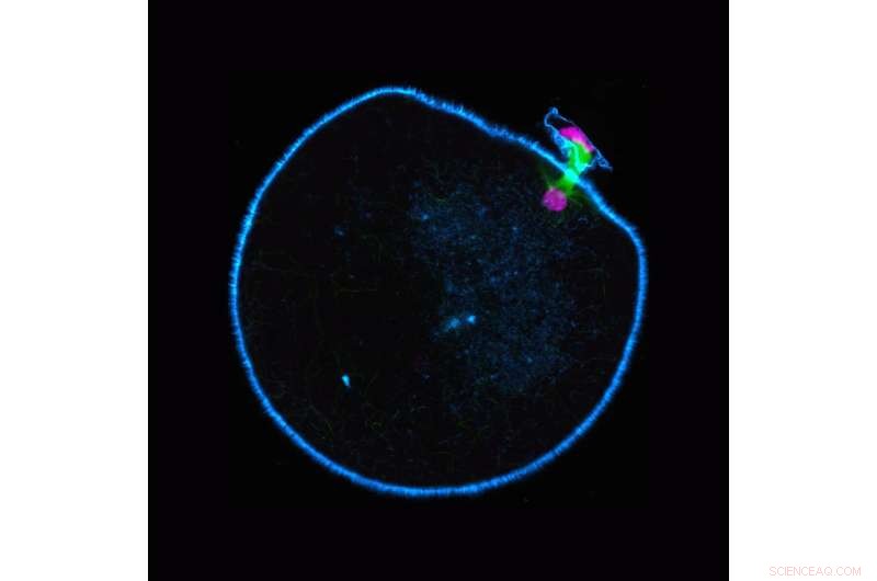 Chromosome Errors in Human Eggs: A Missing Motor Protein s Role