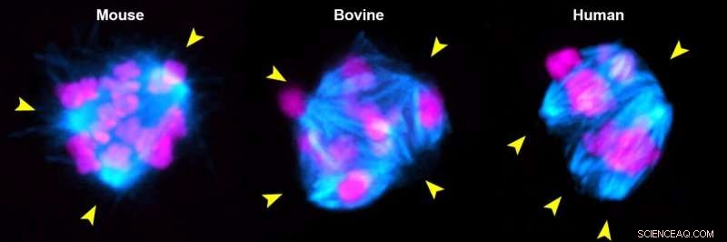 Chromosome Errors in Human Eggs: A Missing Motor Protein s Role