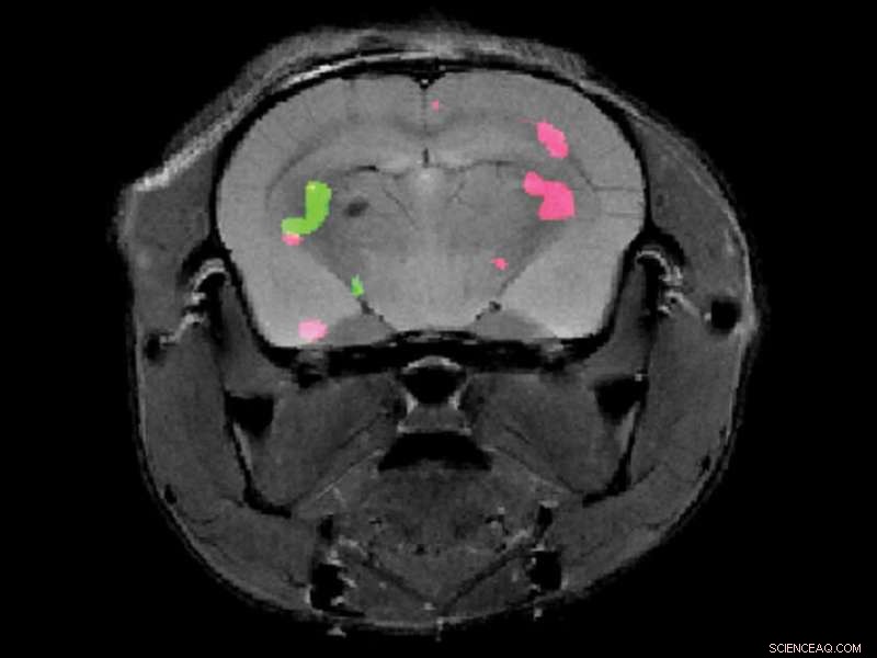 Revolutionary MRI Technique Maps Gene Expression for Potential Cancer & Stem Cell Tracking