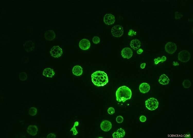 Yeast Vacuoles as Biological Thermometers: Insights into Cellular Membranes