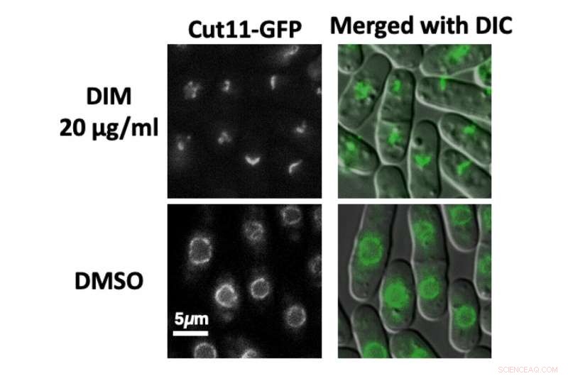 DIM from Broccoli: Potential New Avenue for Cancer Treatment
