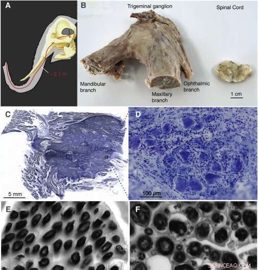 Elephant Trunk Nerve Bundle: Largest Known Structure of Its Kind