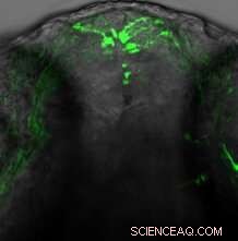 Estrogen s Role in Smell: New Discovery in Zebrafish Embryos