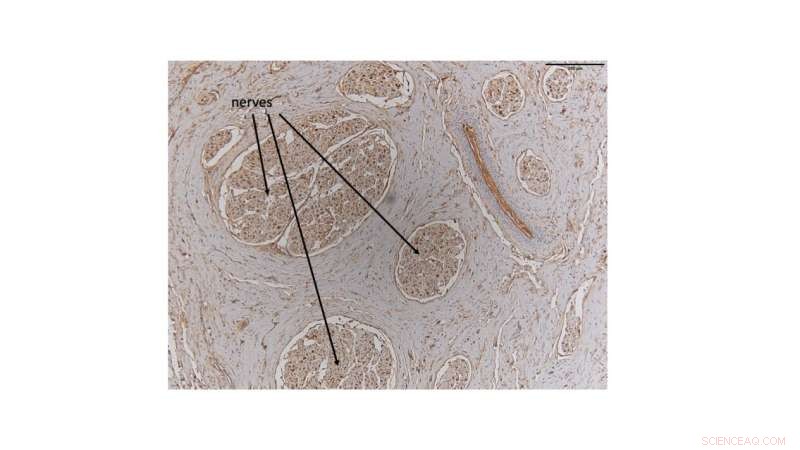 Dolphin Clitoris: New Research Reveals Anatomical Evidence of Functionality