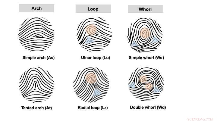 Fingerprint Patterns: New Link to Limb Development Genes