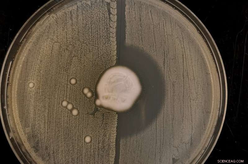 Ancient Origins of MRSA: New Research Reveals Resistance in Hedgehogs Before Antibiotics