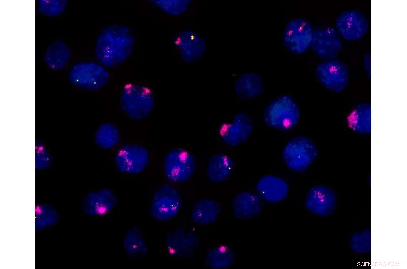 Xist and Xert: Unraveling the Division of Labor in X Chromosome Inactivation