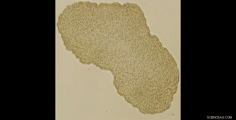 Cancer Resistance Breakthrough: Insights from Trichoplax Adhaerens