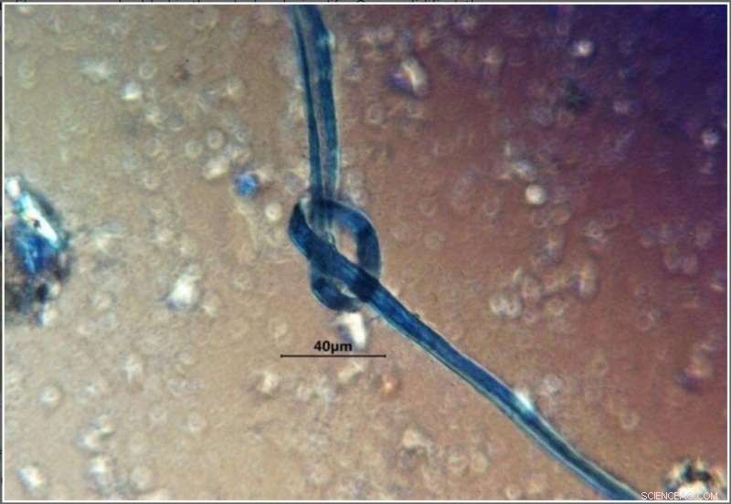 Ancient Mayan Sacrifices: Blue Fibers Suggest Gaging Rituals