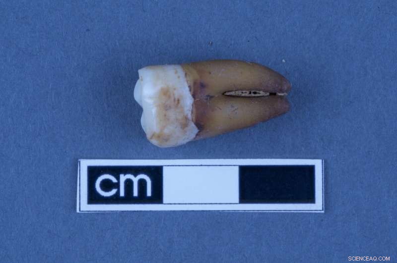 Ancient Teeth Reveal Origins of Early South Australian Colonists