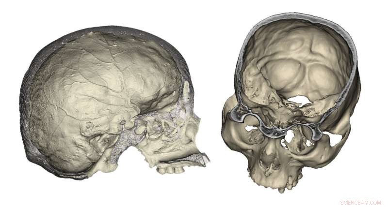 Skull Vascular System Study Reveals Insights into Late Holocene American Populations