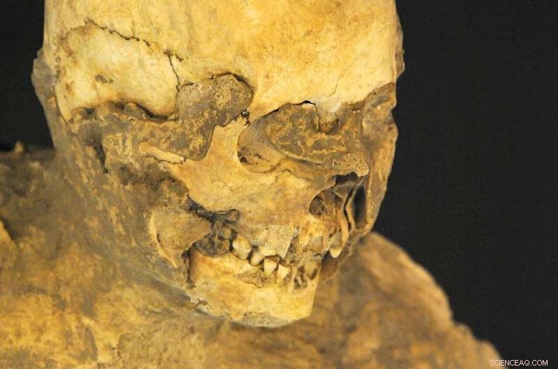 Ancient DNA Reveals First Pompeii Human Genome Sequence