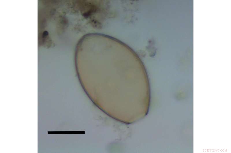 Ancient DNA Reveals Parasites in Stonehenge-Era Human Diet