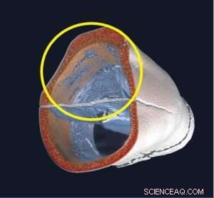 Ancient Australian Skeletal Remains Reveal Insights into Pioneer Settler Health