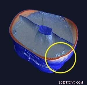 Ancient Australian Skeletal Remains Reveal Insights into Pioneer Settler Health