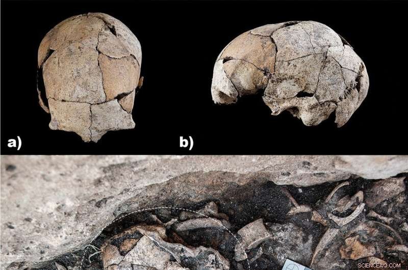 5,300-Year-Old Skull Reveals Ear Surgery: Earliest Evidence Found