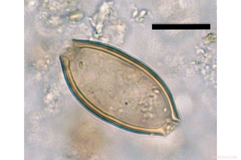 Ancient Roman Chamber Pots: New Insights into Sanitation & Daily Life