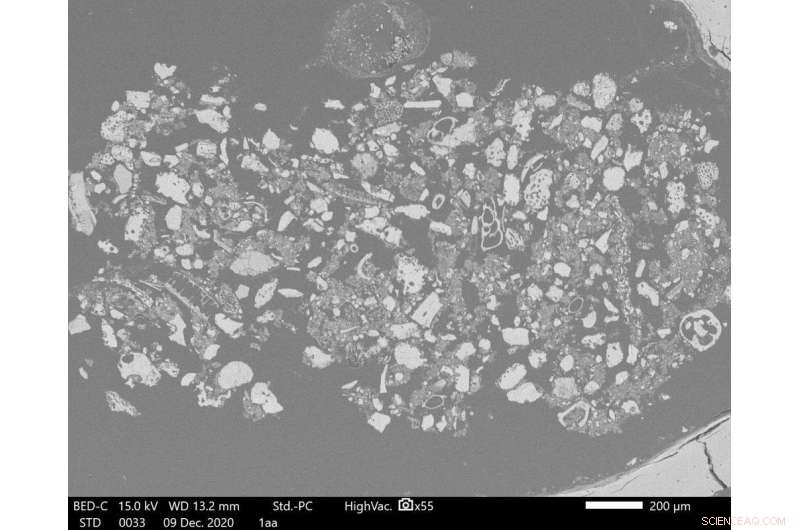 Forensic Science: Unlocking Criminal Mysteries with Ancient Bones