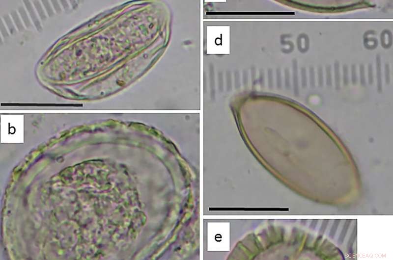 Ancient Toilet Reveals Health of Jerusalem s Elite in First Temple Period
