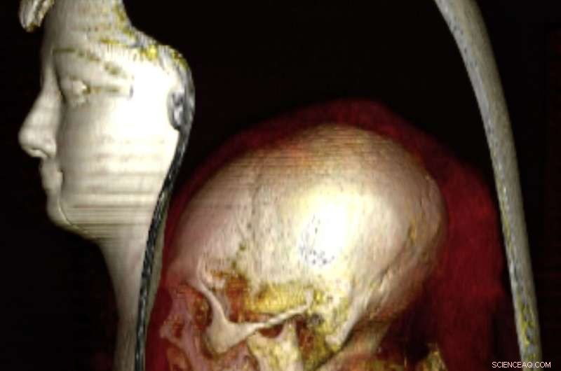 Digital Unwrapping of Pharaoh Amenhotep I: A 3,000-Year-Old Discovery