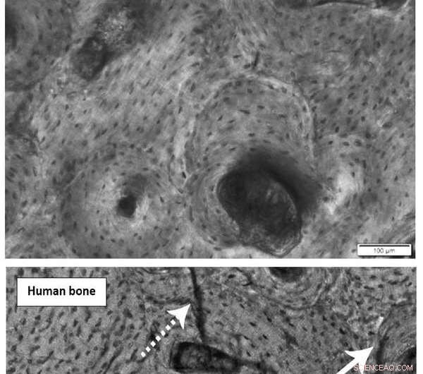 Forensic Science Investigates Fatal Lightning Strikes: Uncovering the Truth