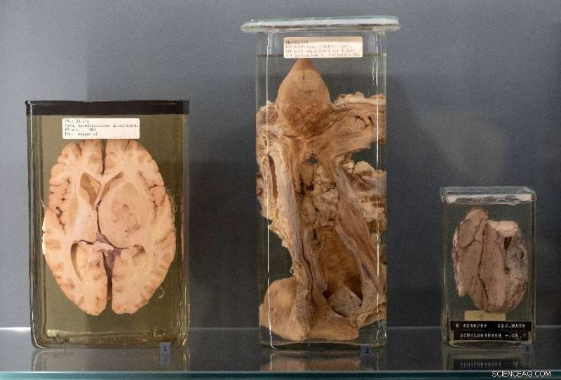 Vienna Natural History Museum Faces Ethical Questions Displaying Human Remains