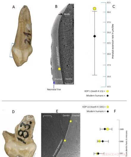 Early Tooth Development in Neanderthals: New Insights from a Preserved Milk Tooth