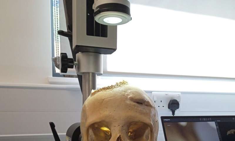 Ancient Egyptian Skull Shows Potential Evidence of Cancer Treatment