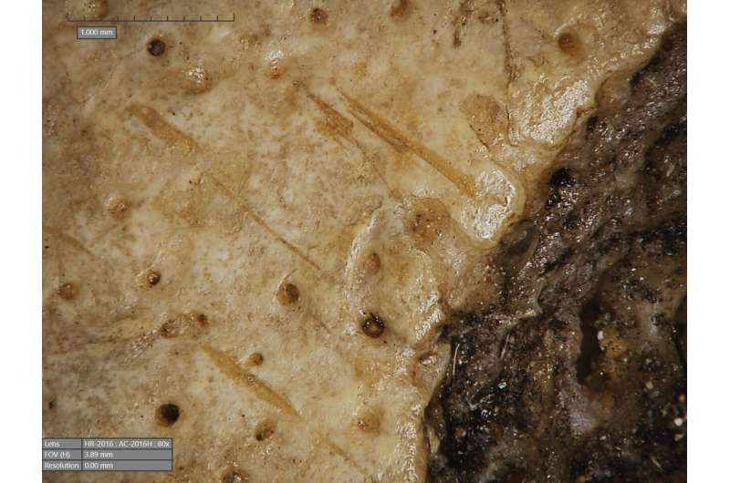 Ancient Egyptian Skull Shows Potential Evidence of Cancer Treatment