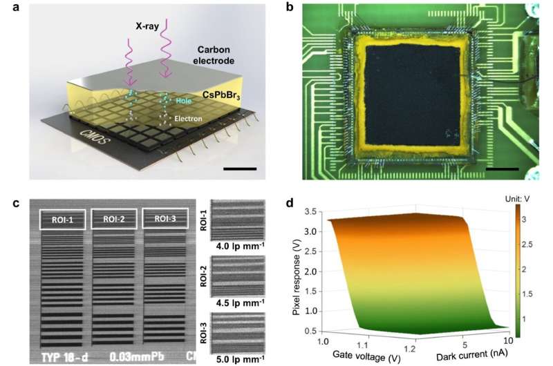 New Perovskite X-ray Detector Revolutionizes Medical Imaging