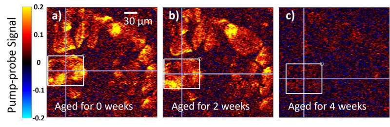 Early Art Damage Detection with Laser Imaging