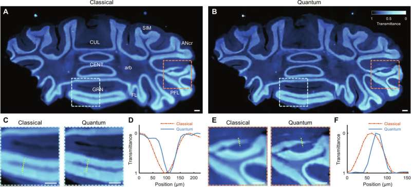 Quantum Imaging with Polarization: Enhancing Resolution and Sensitivity