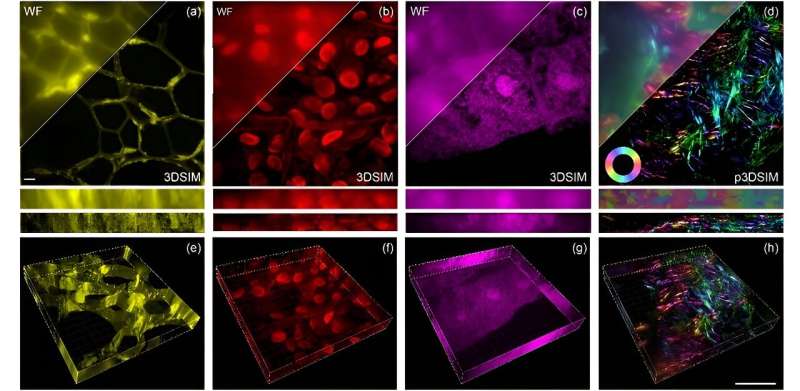 High-Speed 3D Microscopy with Projector Technology