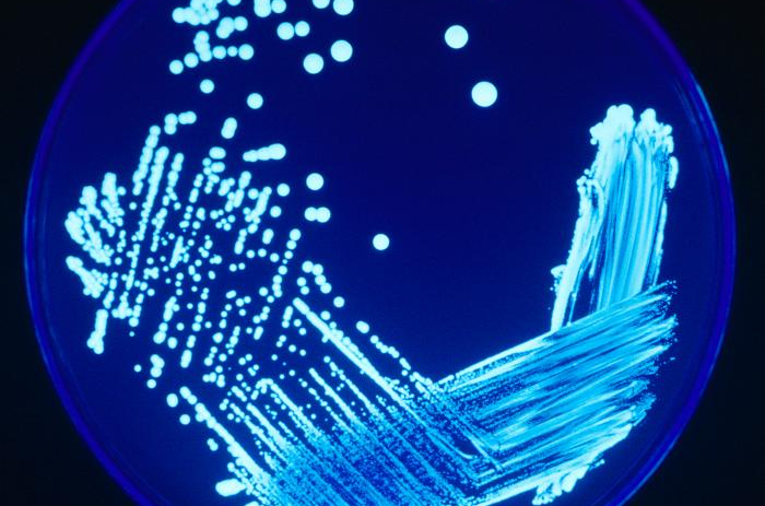 Sulfur Dioxide Decline Linked to Increase in Legionnaires  Disease?