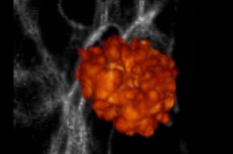 First Galaxies: Understanding Early Universe Enrichment