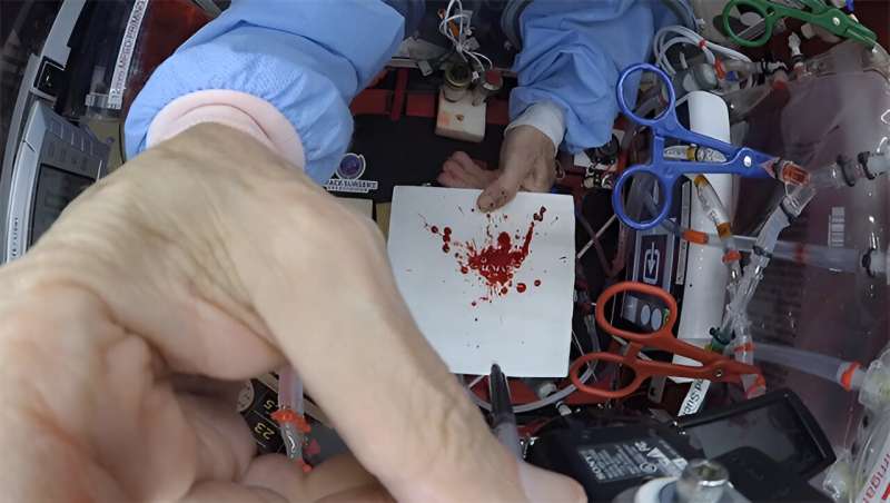 Forensic Science in Space: Bloodstain Pattern Analysis in Microgravity