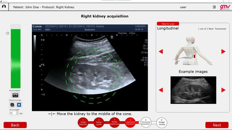 AI-Powered Ultrasound for Astronaut Medical Diagnostics - ALISSE