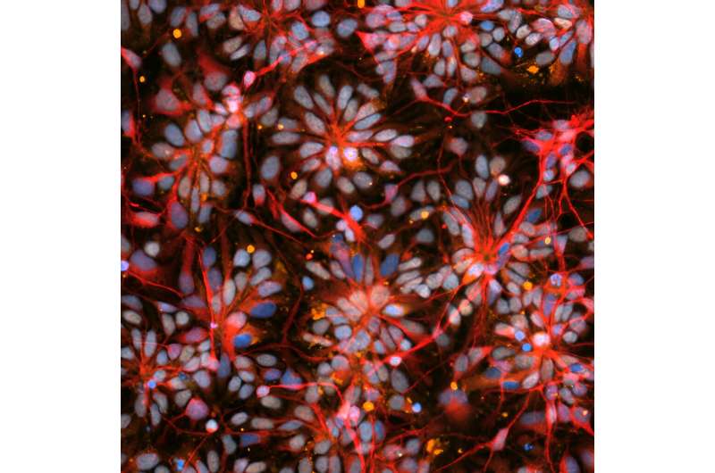 NASA Astronauts to Study Neurological Diseases on International Space Station