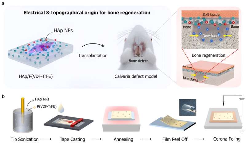 Bioactive Bone Scaffolds: A Novel Approach to Bone Fracture Repair